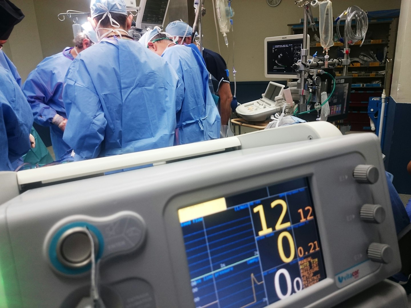 Chirurghi in sala operatoria che esaminano i parametri vitali del paziente.
